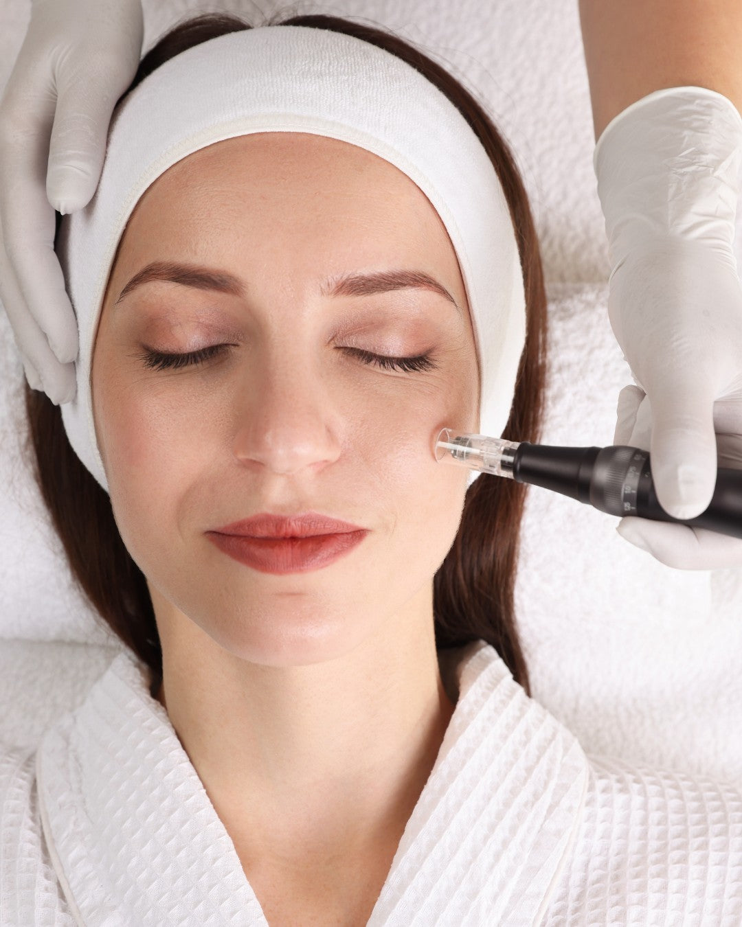 Microneedling