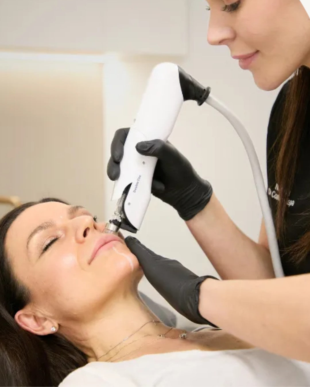 RF Microneedling