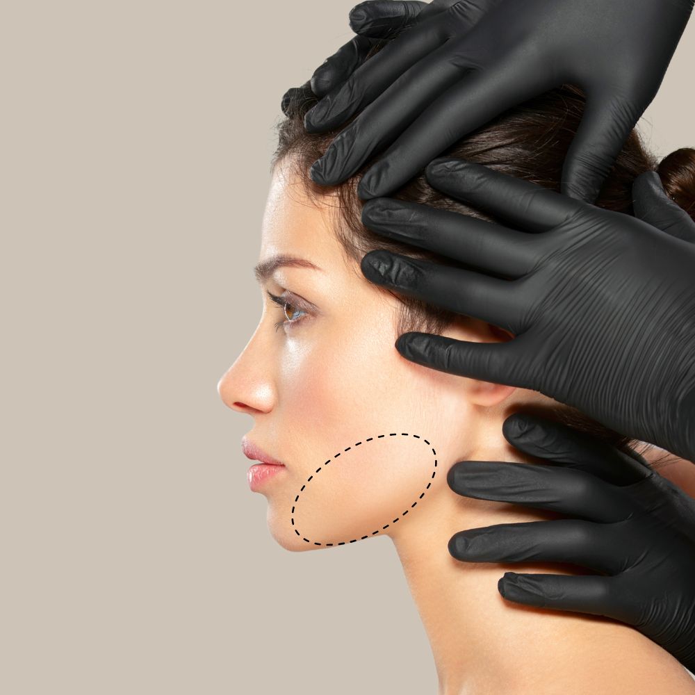 Nefertiti løft | BOTOX OSLO | Dr.CLINICA