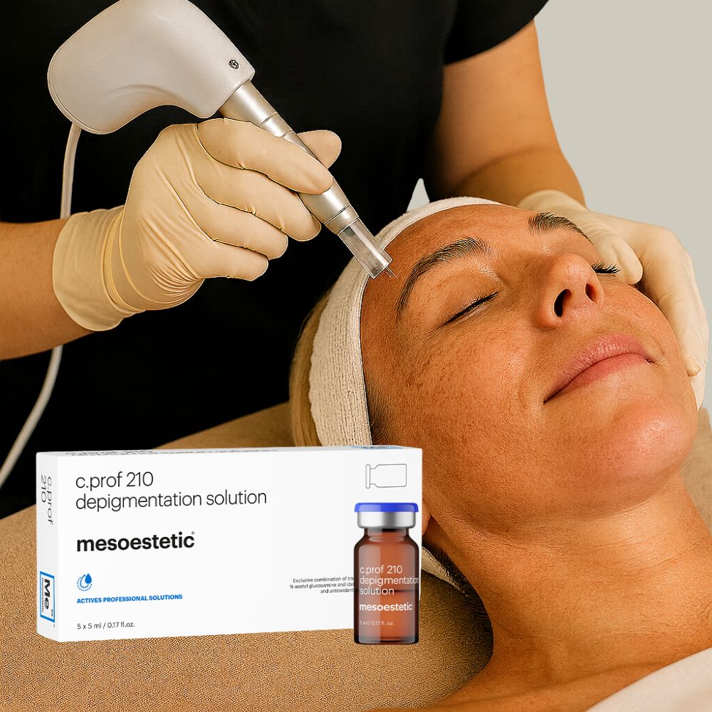 Pigmentflekker Microneedling (Xcellaris®)
