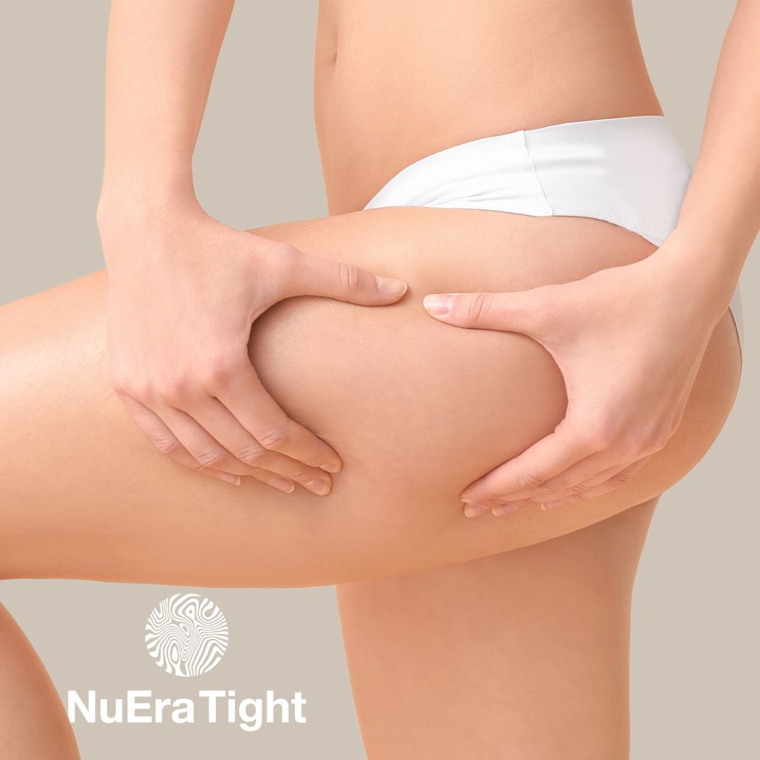 Lår | Hudoppstramming